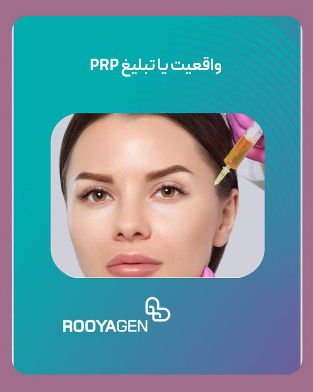 رویاژن